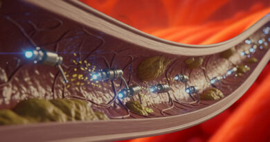 nanoparticles in the treatment of atherosclerosis