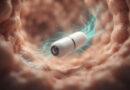 camera capsule and artificial intelligence